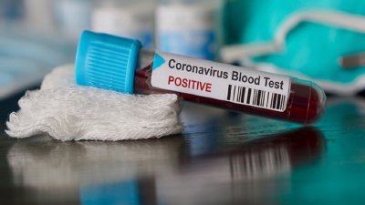 Siguen aumentando los casos de COVID-19 mientras continúa la reapertura económica