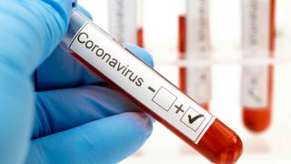 Fotografía genérica de una prueba del coronavirus.