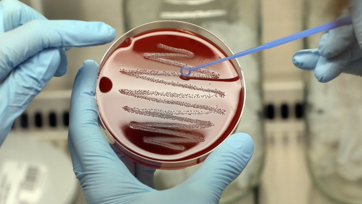 US Hospitals Report Increased Cases of Harmful Bacteria in Children – NBC Fresno