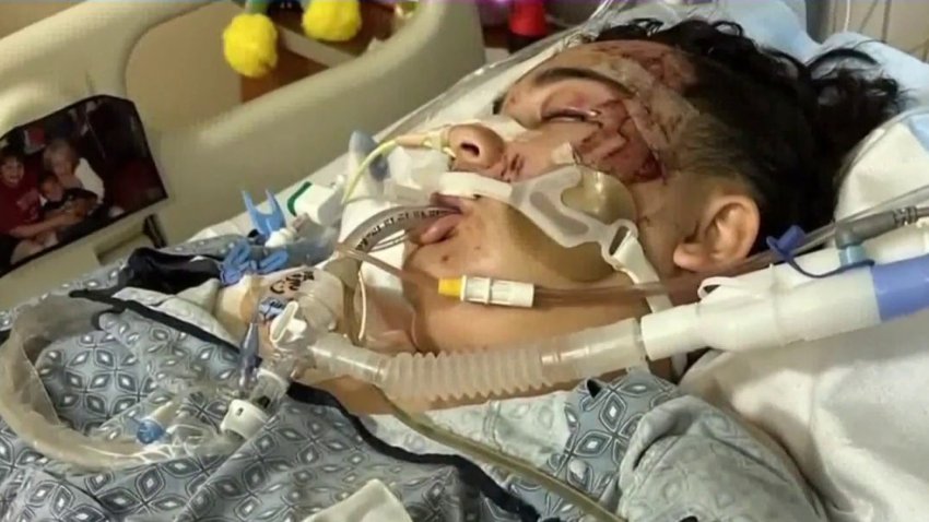 Adolescente sufre aparatoso accidente y se encuentra en coma tras cuatro cirugías