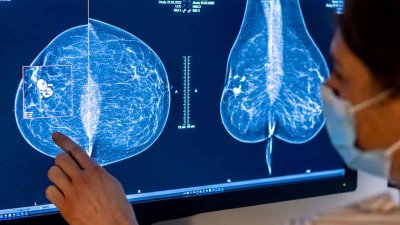La FDA publica nuevas directrices para la realización de mamografías