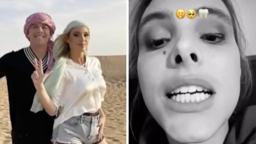 Lele Pons se quiebra un diente durante su luna de miel en Dubai