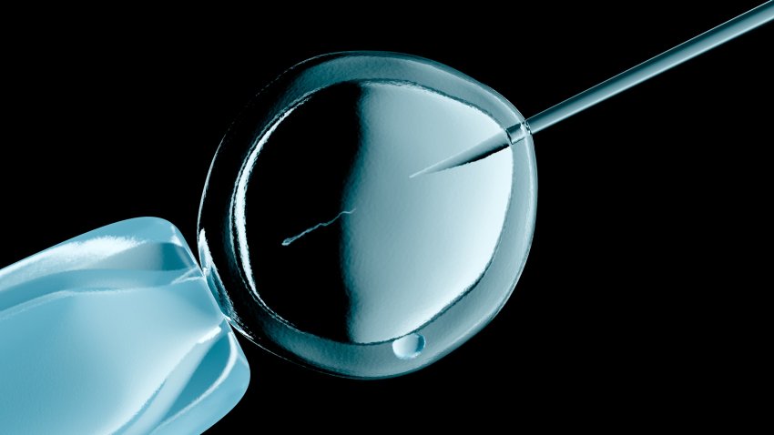 In vitro fertilization, illustration