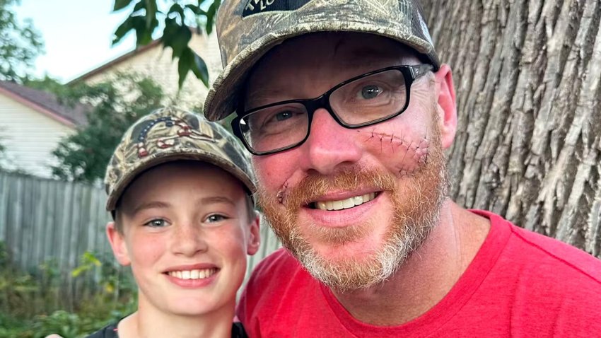 Man with stitches on face smiles with 12-year-old boy