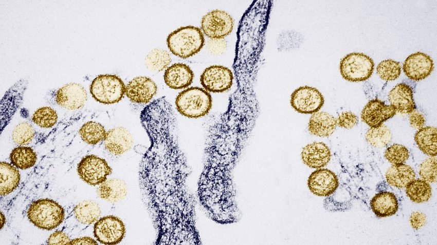 Transmission Electron Micrograph Of The Sin Nombre Hanta Virus. Hantaviruses That Cause Hantavirus Pulmonary Syndrome Hps Are Carried In Rodent Droppings, Especially The Deer Mouse. Incubation Lasts For 1 5Wks. Sickness Begins With Fever And Muscle Aches, Followed By Shortness Of Breath And Coughing. (Photo By BSIP/UIG Via Getty Images)