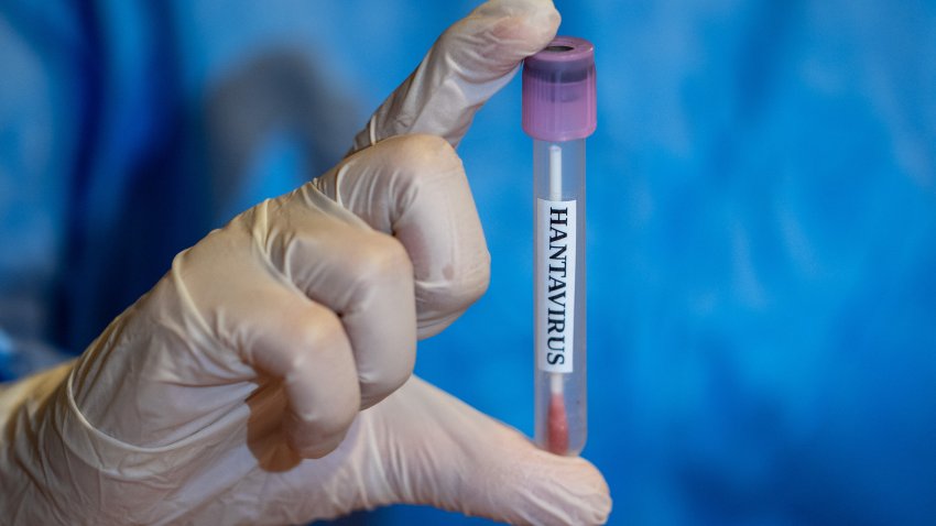 Hantavirus